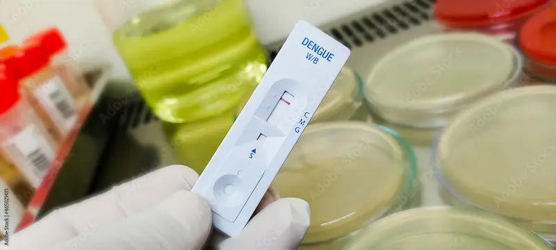 Dengue IgM Positive Results Explained